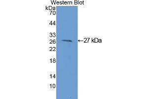Western Blotting (WB) image for anti-Glutathione S-Transferase mu 1 (GSTM1) (AA 1-218) antibody (ABIN1078084) (GSTM1 antibody  (AA 1-218))