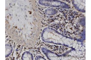 Immunoperoxidase of monoclonal antibody to ACTRT2 on formalin-fixed paraffin-embedded human colon. (ACTRT2 antibody  (AA 209-299))