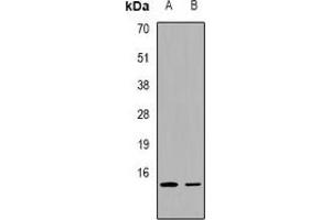 Western blot analysis of FABP2 expression in K562 (A), mouse lung (B) whole cell lysates. (FABP2 antibody  (C-Term))