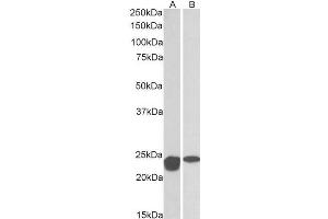 ABIN768566 (0. (SOD2 antibody  (AA 119-130))