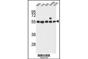 Western blot analysis in WiDr,Y79,293,A2058,A375 cell line lysates (35ug/lane). (GPR180 antibody  (AA 119-147))