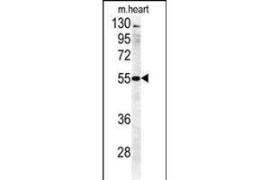 B4GALT5 Antibody (C-term) (ABIN651558 and ABIN2840299) western blot analysis in mouse heart tissue lysates (35 μg/lane). (B4GALT5 antibody  (C-Term))