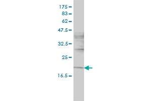 NIFUN monoclonal antibody (M01), clone 3B8-1C4 Western Blot analysis of NIFUN expression in HL-60 . (ISCU antibody  (AA 26-167))