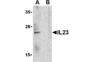 Image no. 1 for anti-Interleukin 23, alpha subunit p19 (IL23A) (C-Term) antibody (ABIN318744) (IL23A antibody  (C-Term))