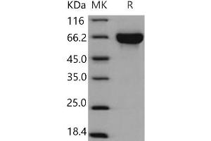 Western Blotting (WB) image for Kin of IRRE Like 3 (KIRREL3) (Active) protein (His tag) (ABIN7320308) (KIRREL3 Protein (His tag))