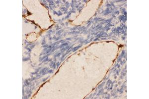 Immunohistochemistry (IHC) image for anti-Platelet/endothelial Cell Adhesion Molecule (PECAM1) (AA 28-382) antibody (ABIN3043601)