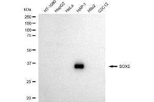 Western blotting analysis using SOX2 antibody (ABIN7800432).
