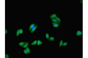 Immunofluorescence (IF) image for anti-Keratin 18 (KRT18) (AA 102-396) antibody (ABIN7157392)
