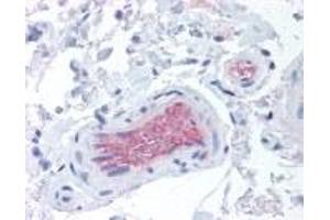 Immunohistochemistry (IHC) image for anti-Complement Factor I (CFI) antibody (ABIN4369126)
