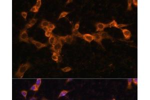 Immunofluorescence analysis of NIH/3T3 cells using PDGFR beta Polyclonal Antibody at dilution of 1:100. (PDGFRB antibody)