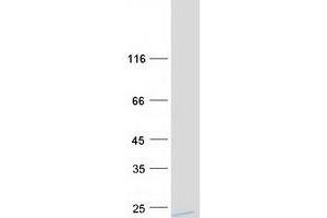 Validation with Western Blot