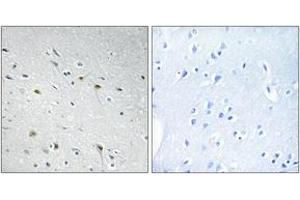 Immunohistochemistry analysis of paraffin-embedded human brain tissue, using CDC25C (Ab-48) Antibody. (CDC25C antibody  (AA 14-63))