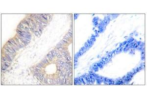 Immunohistochemistry (IHC) image for anti-Cystatin A (Stefin A) (CSTA) (Internal Region) antibody (ABIN1848778) (CSTA antibody  (Internal Region))