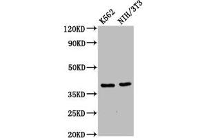 ZNF367 Antikörper  (AA 83-151)