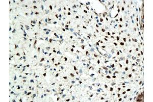 Formalin-fixed and paraffin embedded rat ovary tissue labeled with Anti-ER beta Polyclonal Antibody, Unconjugated (ABIN725210), followed by conjugation to the secondary antibody and DAB staining (ESR2 antibody  (AA 201-300))
