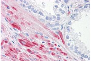 Human Prostate: Formalin-Fixed, Paraffin-Embedded (FFPE) (ADAMTS17 antibody  (AA 543-651))