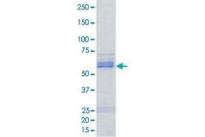 CSNK1A1 Protein (AA 1-337) (GST tag)