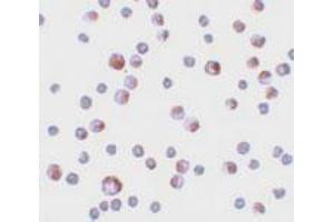 Immunocytochemical staining of HeLa cells with TCTN3 polyclonal antibody  at 4 ug/mL. (TCTN3 antibody  (C-Term))