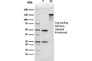 SDS-PAGE Analysis Purified ACTN4 Mouse Monoclonal Antibody (93). (alpha Actinin 4 antibody)