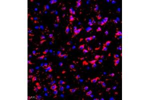 Immunofluorescence of paraffin embedded mouse brain using eIF5A2 (ABIN7073893) at dilution of 1:300 (400x lens) (EIF5A2 antibody)