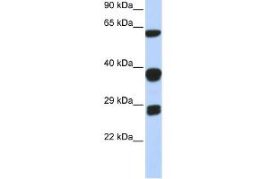 WB Suggested Anti-SNRPB Antibody Titration:  0. (SNRPB antibody  (Middle Region))