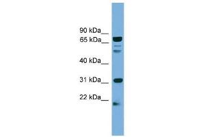 SLC6A3 antibody used at 0. (SLC6A3 antibody  (N-Term))