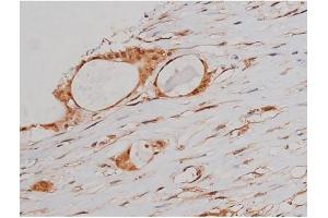 Immunohistochemistry (IHC) image for anti-Microtubule-Associated Protein tau (MAPT) (pSer262) antibody (ABIN6256228)
