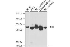 Western blot analysis of extracts of various cell lines using CA2 Polyclonal Antibody at dilution of 1:1000. (CA2 antibody)