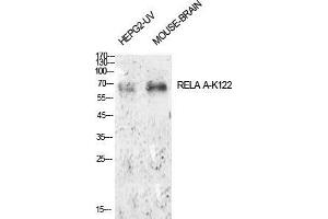 Western Blot (WB) analysis of HepG2-UV, Mouse Brain cells using Acetyl-NFkappaB-p65 (K122) Polyclonal Antibody. (NF-kB p65 antibody  (acLys122))