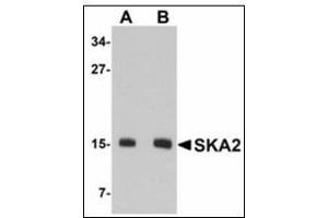 Western blot analysis of SKA2 in 3T3 cell lysate with SKA2 antibody at (A) 0.