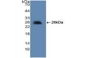 Detection of Recombinant cPLA2, Human using Polyclonal Antibody to Cytosolic Phospholipase A2 (PLA2G4) (PLA2G4A antibody  (AA 1-178))