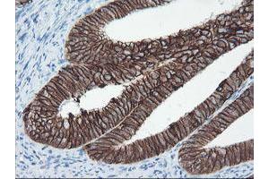 Image no. 2 for anti-Signal Recognition Particle Receptor, B Subunit (SRPRB) antibody (ABIN1501126) (SRPRB antibody)