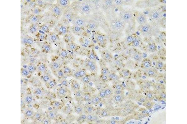 HSD17B13 antibody