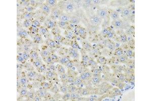 Immunohistochemistry of paraffin-embedded Mouse liver using HSD17B13 Polyclonal Antibody at dilution of 1:100 (40x lens).