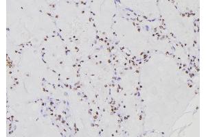 Immunohistochemistry (IHC) image for anti-Replication Factor C (Activator 1) 1, 145kDa (RFC1) (Internal Region) antibody (ABIN6264709)