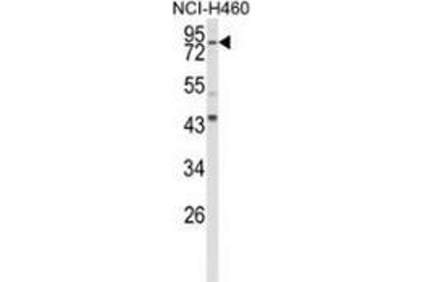 SPG20 Antikörper  (N-Term)