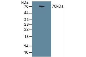 Detection of CHGA in Human Serum using Polyclonal Antibody to Chromogranin A (CHGA) (Chromogranin A antibody  (AA 15-148))