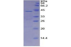 SDS-PAGE (SDS) image for alpha-2-HS-Glycoprotein (AHSG) ELISA Kit (ABIN6730899)