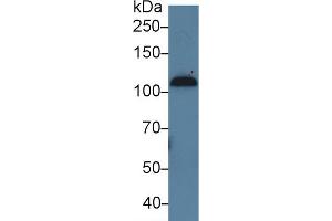 Western Blot; Sample: Human Serum; Primary Ab: 5µg/ml Rabbit Anti-Human C7 Antibody Second Ab: 0. (C7 antibody  (AA 122-456))
