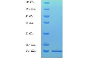 Histone H2B Type 2-E (HIST2H2BE) (AA 2-93) protein (His tag)