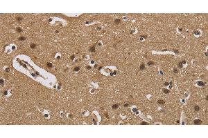 Immunohistochemistry of paraffin-embedded Human brain using FABP2 Polyclonal Antibody at dilution of 1:40 (FABP2 antibody)