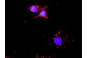 Proximity Ligation Analysis of protein-protein interactions between TP53 and LAMA4. (LAMa4 antibody  (AA 1-120))