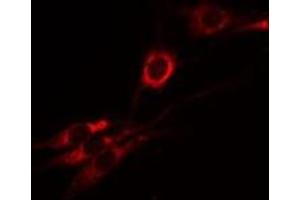 ABIN6274970 staining A549 by IF/ICC. (CPM antibody  (Internal Region))