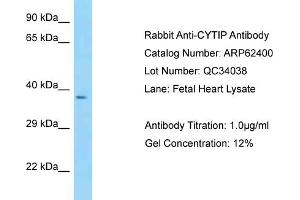 Western Blotting (WB) image for anti-Cytohesin 1 Interacting Protein (CYTIP) (N-Term) antibody (ABIN970496) (CYTIP antibody  (N-Term))