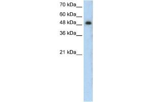 WB Suggested Anti-PRKCZ Antibody Titration:  0. (PKC zeta antibody  (N-Term))