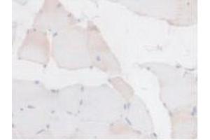Detection of BCKDK in Rat Skeletal Muscle Tissue using Polyclonal Antibody to Branched Chain Alpha-Ketoacid Dehydrogenase Kinase (BCKDK) (BCKDK antibody  (AA 44-223))