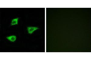 Peptide - +Immunofluorescence analysis of LOVO cells, using CHRM4 antibody. (CHRM4 antibody  (Internal Region))