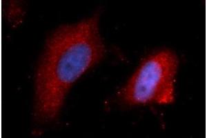 Immunofluorescence (IF) image for anti-Interleukin 15 (IL15) (AA 49-162) antibody (APC) (ABIN5565742) (IL-15 antibody  (AA 49-162) (APC))