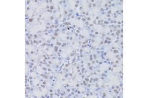 Immunohistochemistry of paraffin-embedded rat pancreas using JMJD6 Antibody (ABIN5973452) at dilution of 1/100 (40x lens). (JMJD6 antibody)