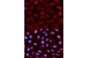 Immunofluorescence analysis of U2OS cells using FMR1 antibody. (FMR1 antibody)